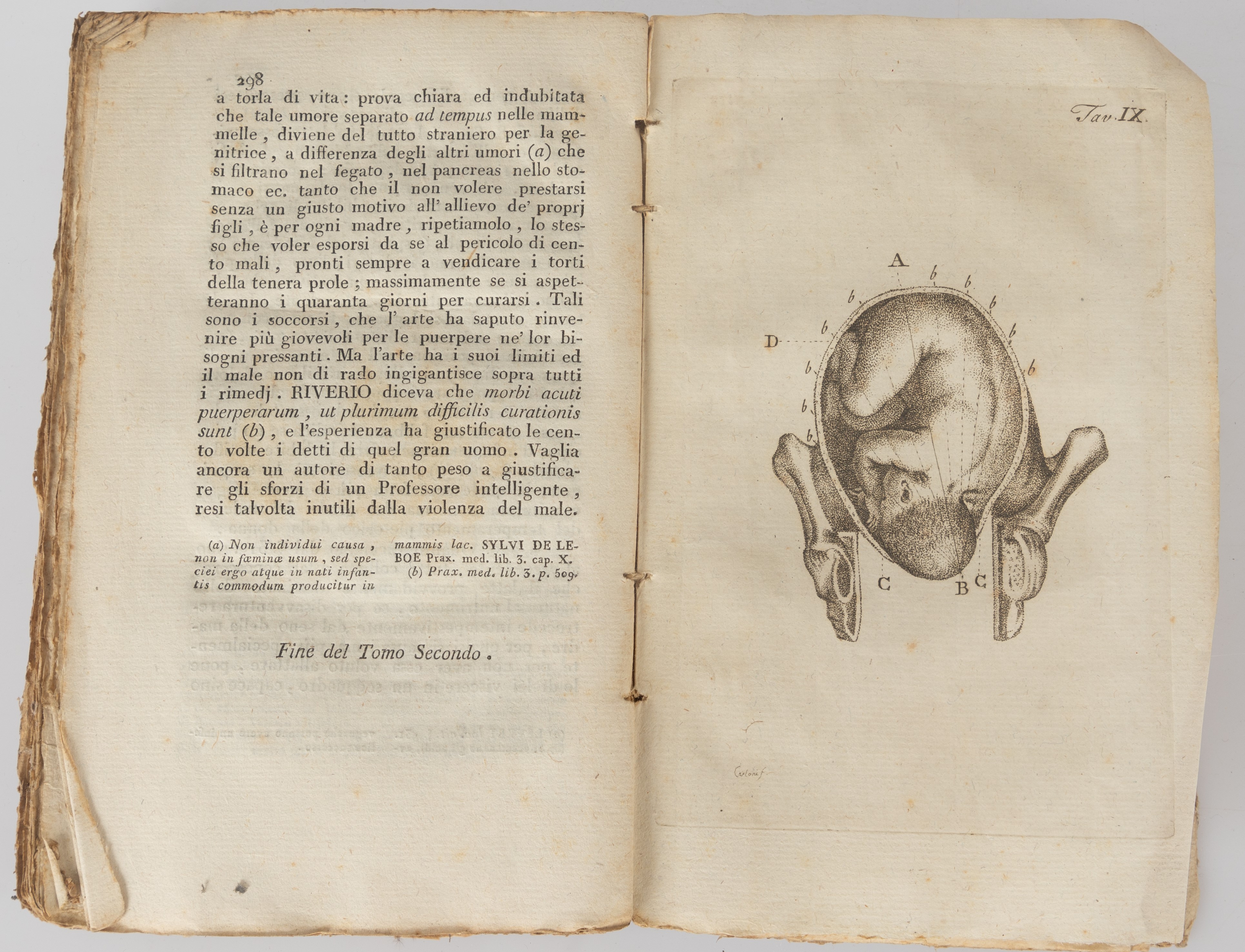 Francesco Asdrubali - Trattato Generale di Ostetricia Teoretica e Prattica.