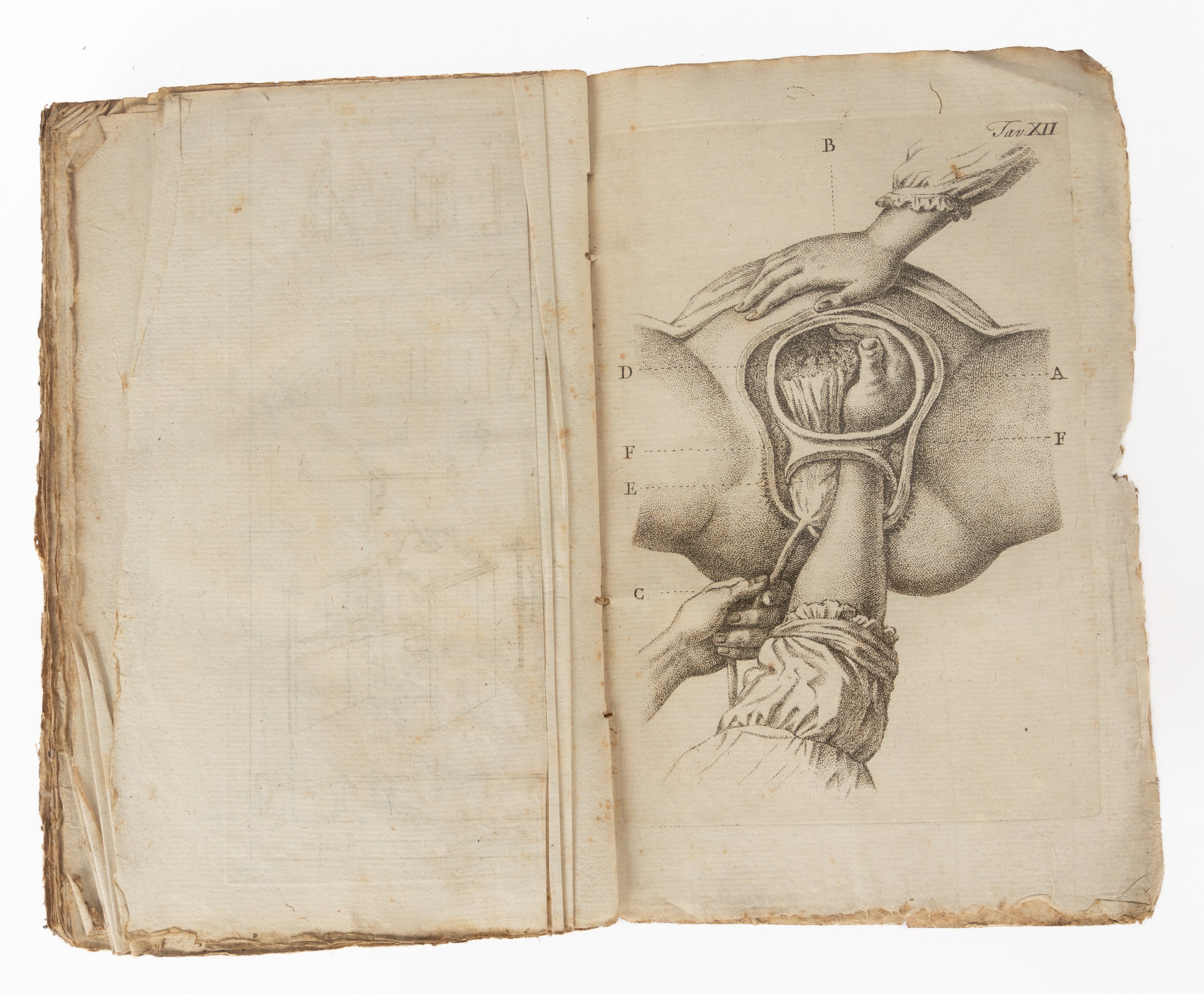 Francesco Asdrubali - Trattato Generale di Ostetricia Teoretica e Prattica.