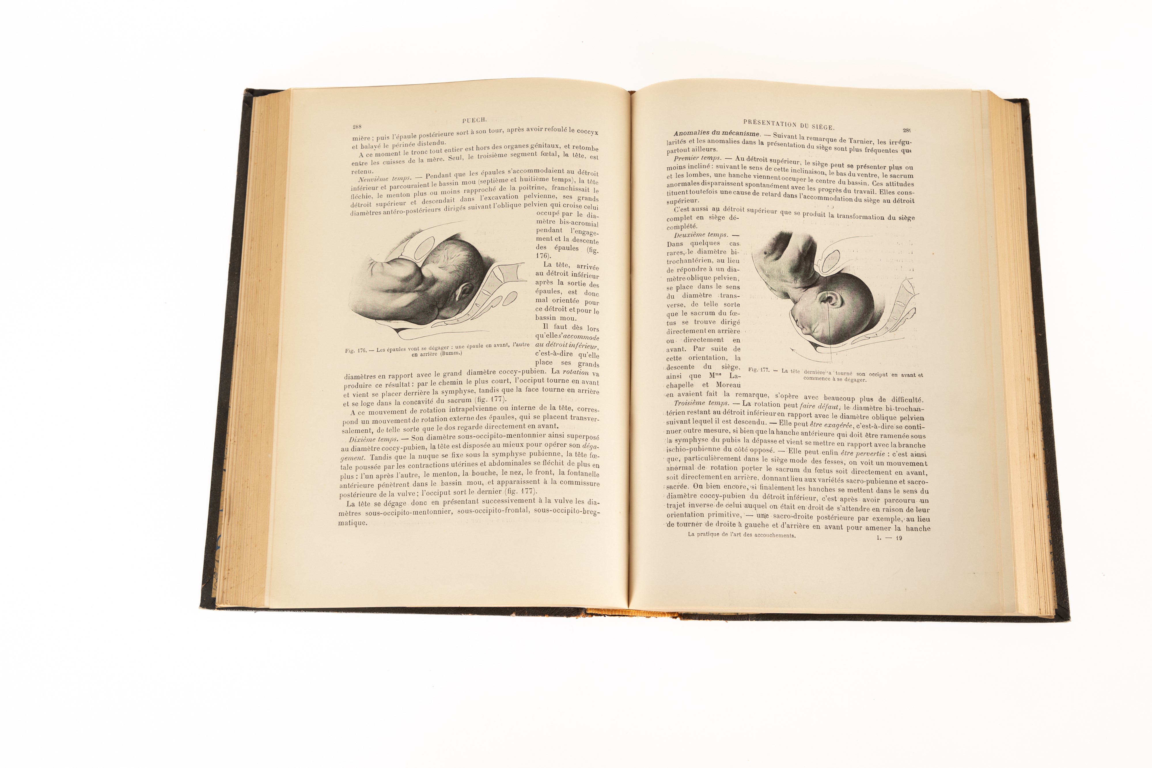 La pratique de lʹart des accouchements