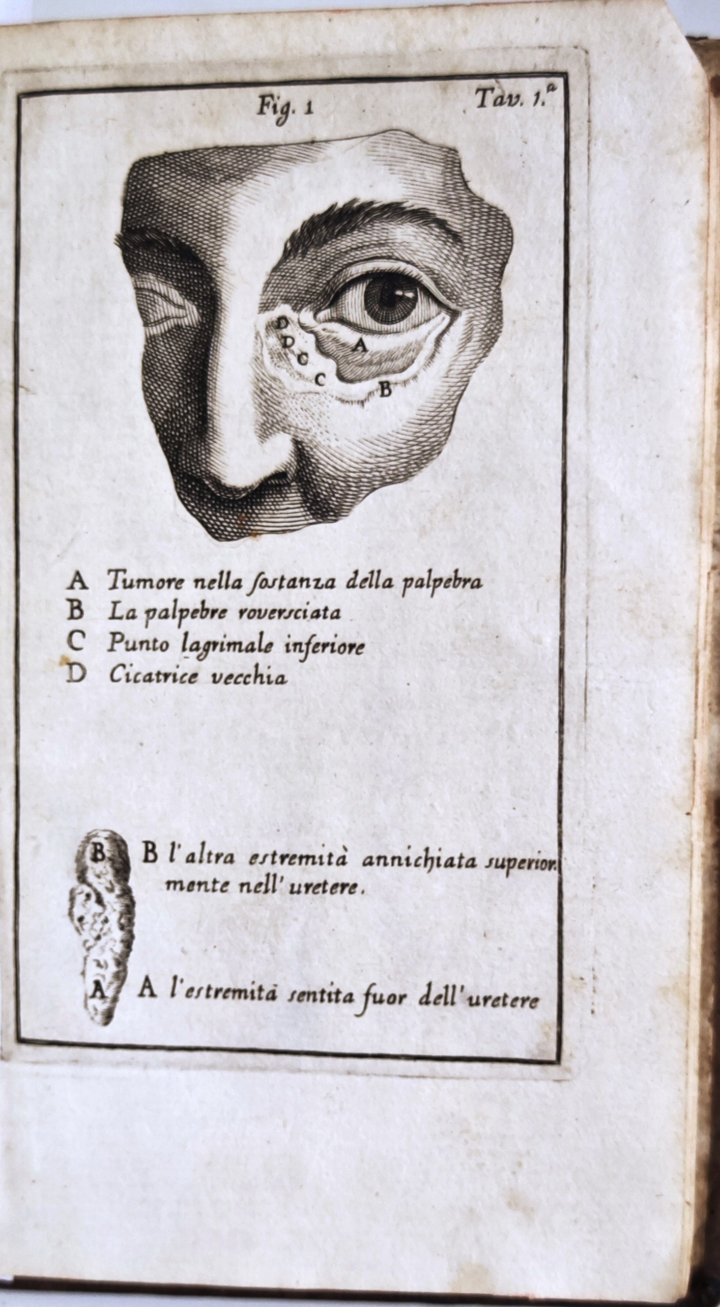 Osservazioni di Chirurgia