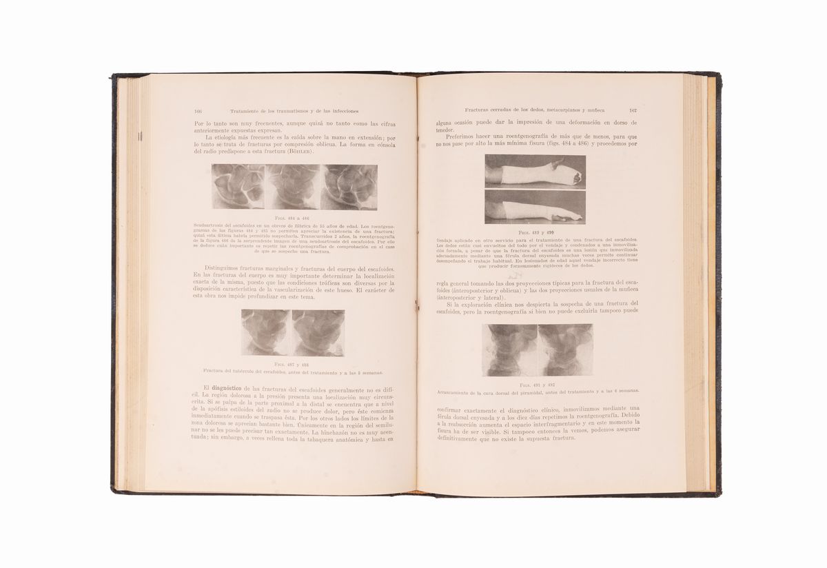 Traumatología De la Mano