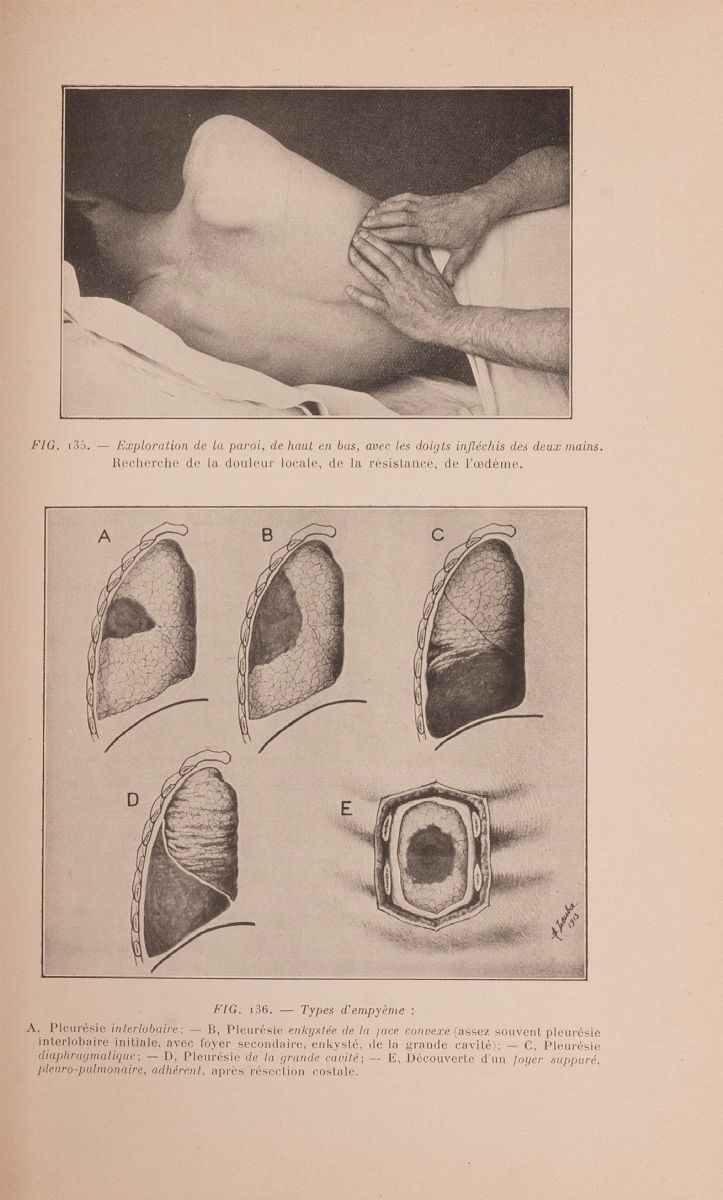 Exploration Clinique Et Diagnostic Chirurgical di Felix Lejars