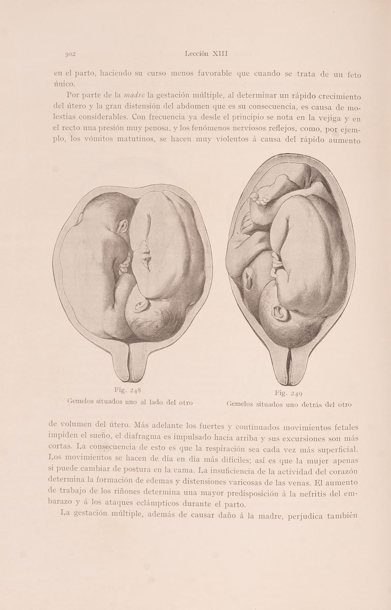 Tratado Completo De Obstetricia Escrito Para Los Estudiantes Y Médicos