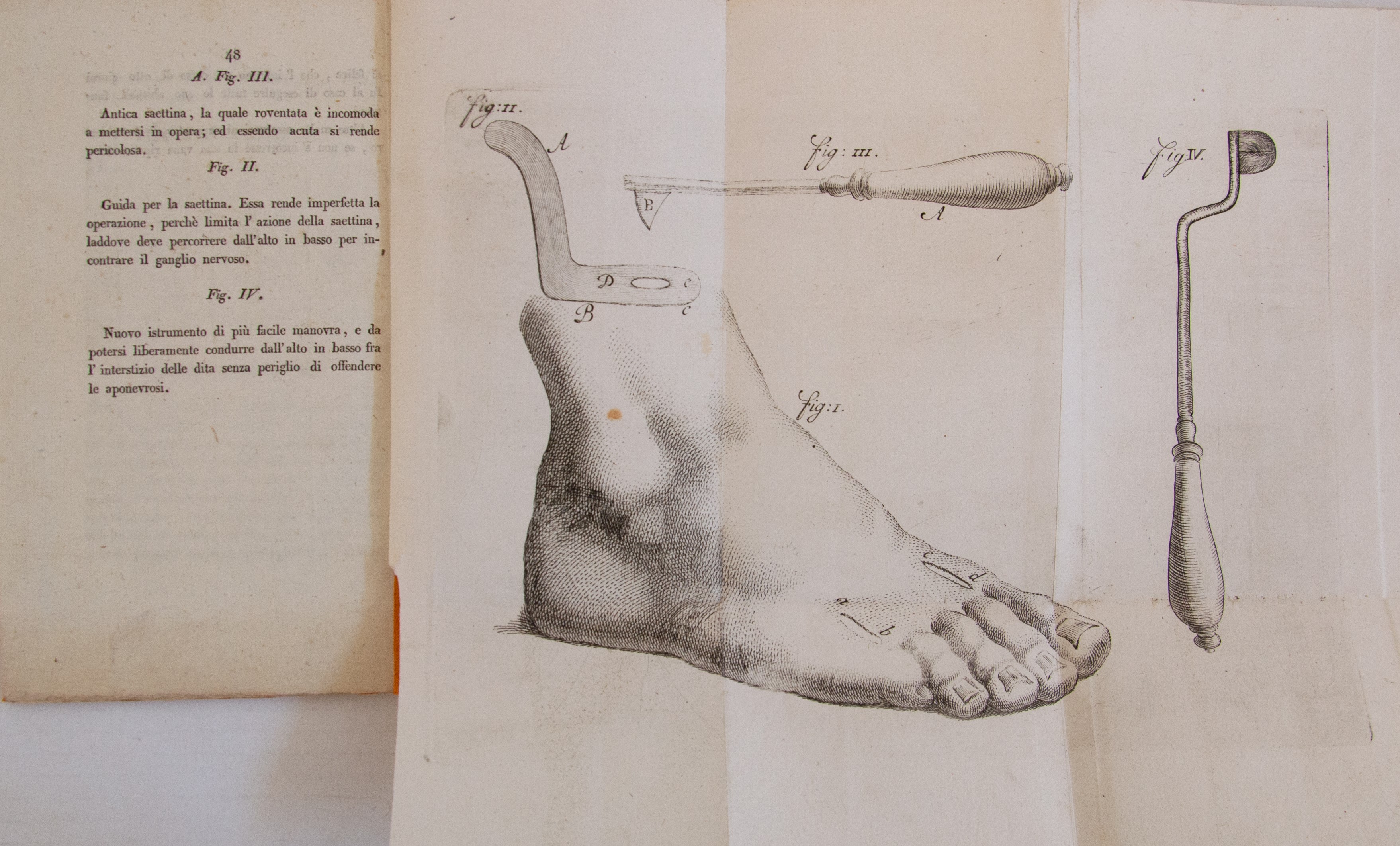 Petrini, Luigi. Memoria sulla sciatica nervosa.